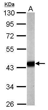 pyruvate dehydrogenase E1 alpha 1 subunit Antibody