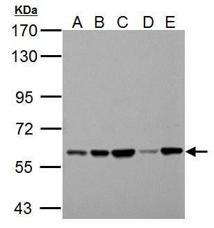 pyruvate kinase L/R Antibody