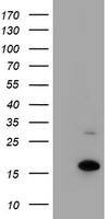 Pyruvate Kinase Antibody