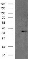 Pyruvate Kinase Antibody