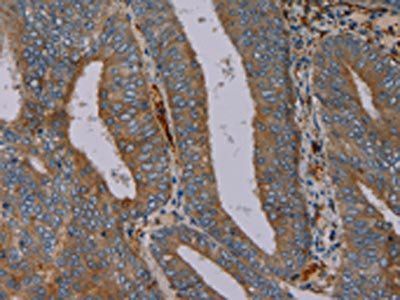PYY Antibody