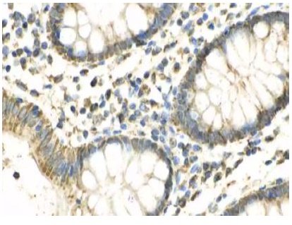 SUCLA2 Antibody