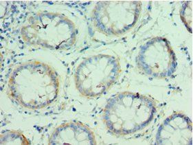 QARS Antibody