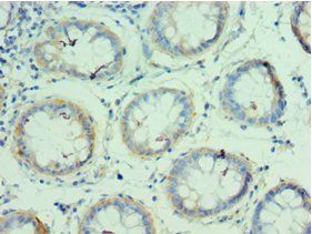 QARS antibody