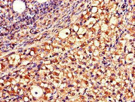 QDPR Antibody