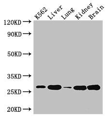 QDPR antibody