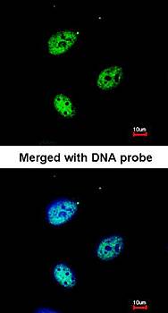 QIP1 Rabbit Polyclonal Antibody
