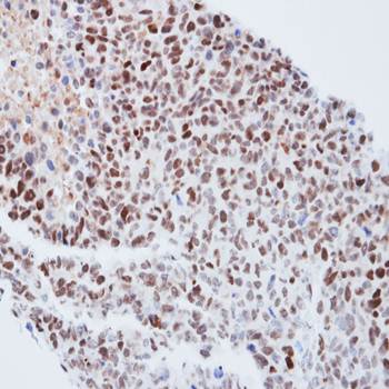 QIP1 Rabbit Polyclonal Antibody