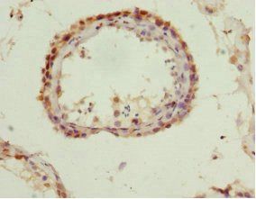 QKI Antibody