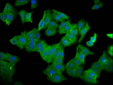 QPRT Antibody