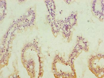 QRSL1 Antibody
