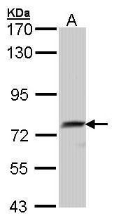 matrix metallopeptidase 2 Antibody