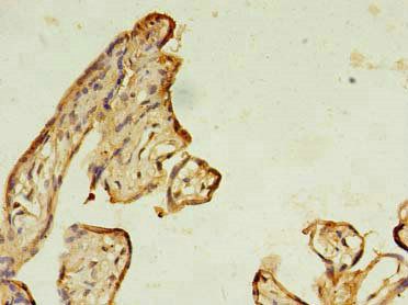RAB11B Antibody