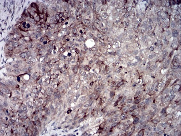 RAB11FIP1 Antibody