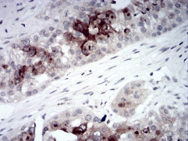 RAB11FIP1 Antibody