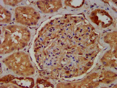RAB11FIP5 Antibody