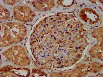 RAB11FIP5 antibody