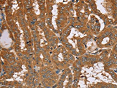 RAB14 Antibody