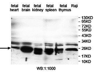 RAB14 Rabbit Polyclonal Antibody