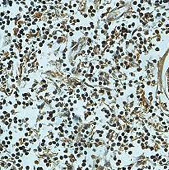 RAB14 Rabbit Polyclonal Antibody