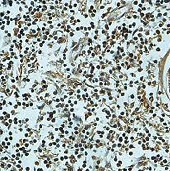 RAB14 antibody