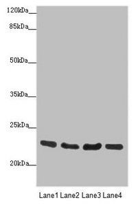 RAB18 antibody