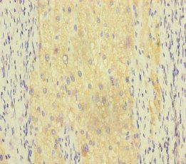 RAB18 Antibody