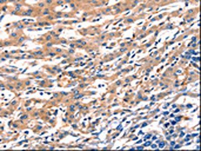 RAB18 Antibody
