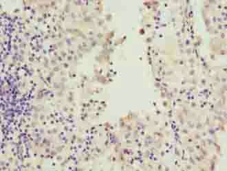 RAB20 Antibody