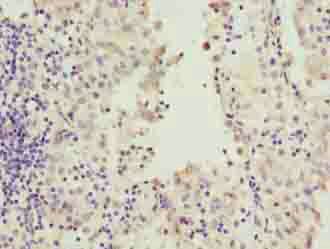 RAB20 antibody