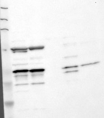 RAB21 Antibody