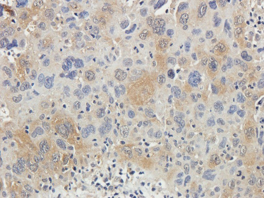 RAB21 antibody