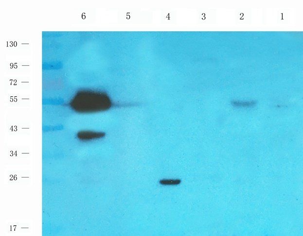 RAB21 antibody