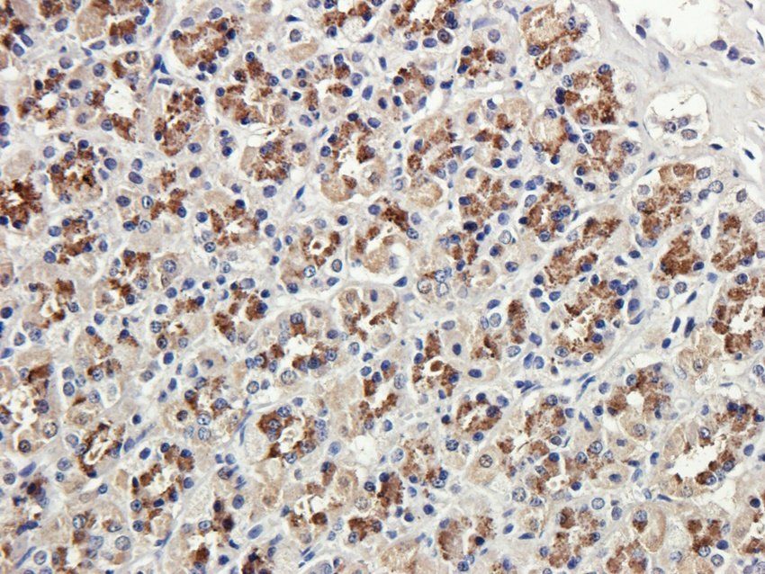 RAB21 antibody