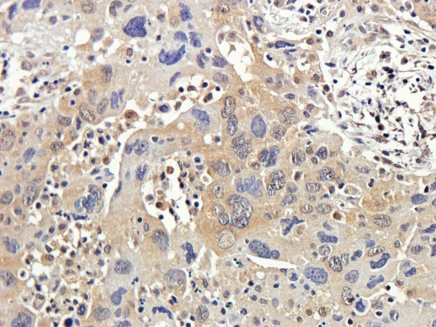 RAB21 antibody