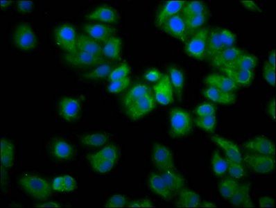 RAB21 antibody