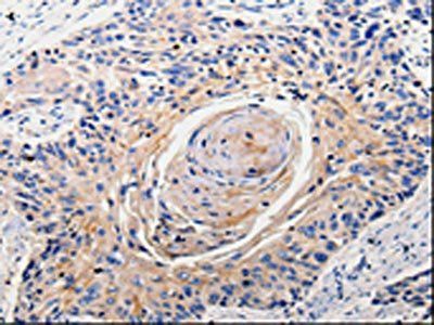 RAB22A Antibody
