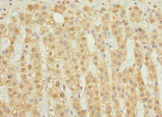 RAB23 Antibody