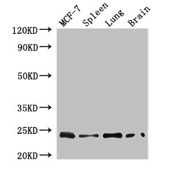 RAB25 antibody