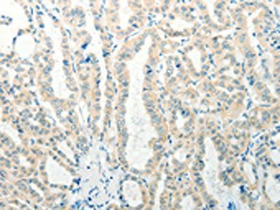 RAB25 antibody