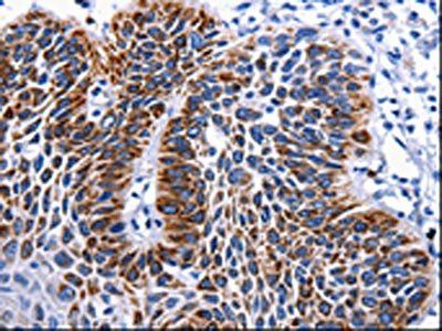 RAB25 Antibody