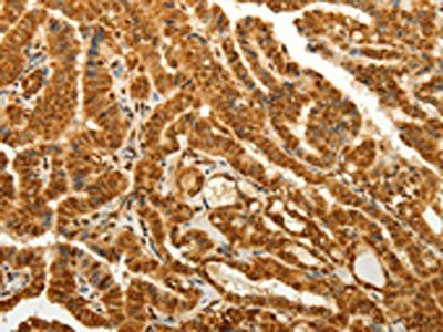 RAB26 Antibody