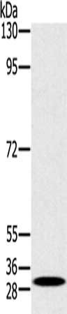 RAB27A Antibody