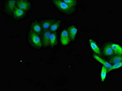 RAB27A antibody