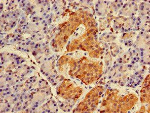 RAB27A Antibody