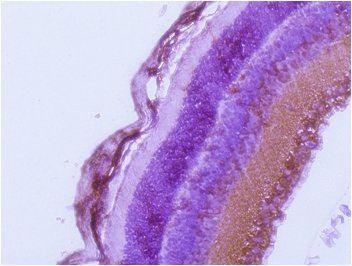 Rab27a antibody