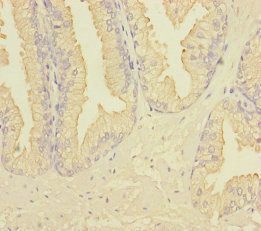 RAB27B Antibody