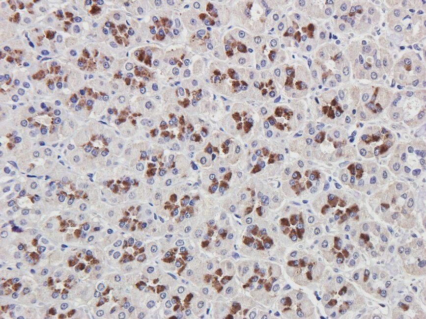 Rab28 antibody