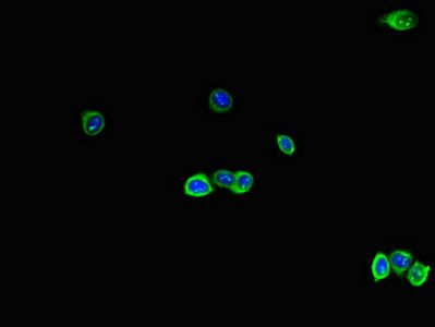 RAB28 Antibody