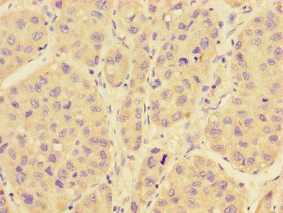 RAB28 Antibody